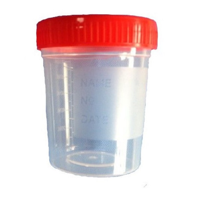 Frasco recogida orina 125 ml