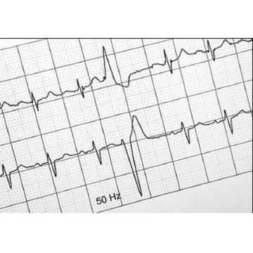 Rollo Papel ECG 100*20*16E.Cardioline ECG100L