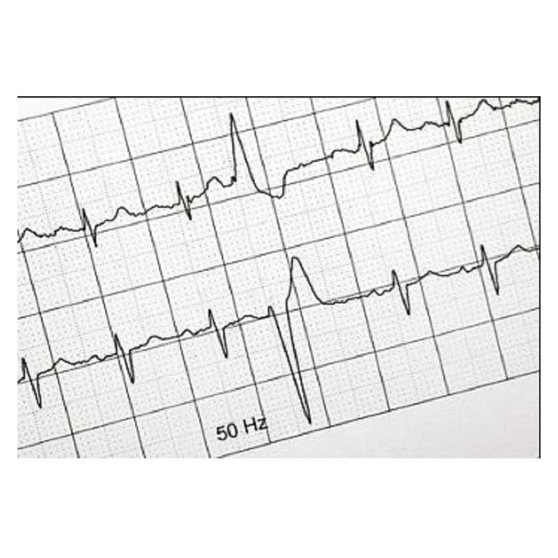 Rollo Papel ECG 100*20*16E.Cardioline ECG100L