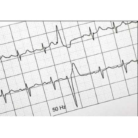 Rollo Papel ECG 100*20*16E.Cardioline ECG100L