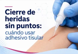 Cierre de heridas sin puntos: cuándo usar adhesivo tisular