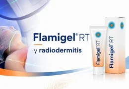 Flamigel RT: qué es y cómo ayuda en la radiodermitis